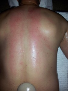 סימנים שמשאיר הגוף